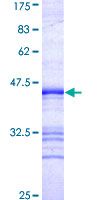 PDCD2L Protein - 12.5% SDS-PAGE Stained with Coomassie Blue.