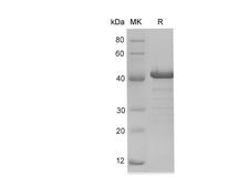 PDCD4 Protein - Recombinant Human PDCD4 protein (His Tag)