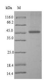 PDCD5 Protein - (Tris-Glycine gel) Discontinuous SDS-PAGE (reduced) with 5% enrichment gel and 15% separation gel.