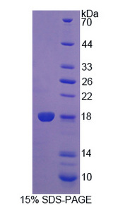 PDCD5 Protein - Recombinant Programmed Cell Death Protein 5 By SDS-PAGE