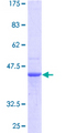 PDCD6 / ALG-2 Protein - 12.5% SDS-PAGE of human PDCD6 stained with Coomassie Blue