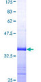 PDCD6 / ALG-2 Protein - 12.5% SDS-PAGE Stained with Coomassie Blue.