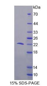 PDCD6 / ALG-2 Protein - Recombinant  Programmed Cell Death Protein 6 By SDS-PAGE