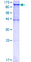 PDCD6IP / ALIX Protein - 12.5% SDS-PAGE of human PDCD6IP stained with Coomassie Blue