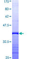 PDCD6IP / ALIX Protein - 12.5% SDS-PAGE Stained with Coomassie Blue.
