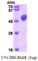 PDCD6IP / ALIX Protein