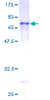 PDCL Protein - 12.5% SDS-PAGE of human PDCL stained with Coomassie Blue