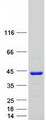 PDCL Protein - Purified recombinant protein PDCL was analyzed by SDS-PAGE gel and Coomassie Blue Staining