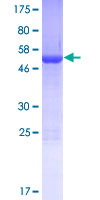 PDCL2 Protein - 12.5% SDS-PAGE of human PDCL2 stained with Coomassie Blue