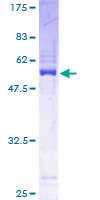 PDCL3 Protein - 12.5% SDS-PAGE of human PDCL3 stained with Coomassie Blue