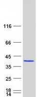 PDCL3 Protein - Purified recombinant protein PDCL3 was analyzed by SDS-PAGE gel and Coomassie Blue Staining