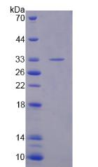 PDE10A Protein - Recombinant Phosphodiesterase 10A By SDS-PAGE