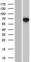 PDE12 Protein - Western validation with an anti-DDK antibody * L: Control HEK293 lysate R: Over-expression lysate