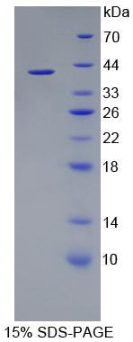 PDE1A Protein - Recombinant  Phosphodiesterase 1A, Calmodulin Dependent By SDS-PAGE