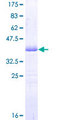 PDE3A Protein - 12.5% SDS-PAGE Stained with Coomassie Blue.