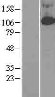 PDE4B Protein - Western validation with an anti-DDK antibody * L: Control HEK293 lysate R: Over-expression lysate