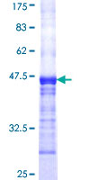 PDE4B Protein - 12.5% SDS-PAGE Stained with Coomassie Blue.