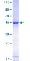 PDE4DIP / MMGL Protein - 12.5% SDS-PAGE of human PDE4DIP stained with Coomassie Blue