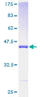 PDE6D / PDE6 Delta Protein - 12.5% SDS-PAGE of human PDE6D stained with Coomassie Blue