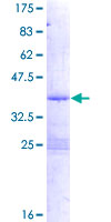 PDE6H Protein - 12.5% SDS-PAGE of human PDE6H stained with Coomassie Blue