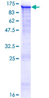PDE8A Protein - 12.5% SDS-PAGE of human PDE8A stained with Coomassie Blue