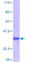 PDE9A Protein - 12.5% SDS-PAGE Stained with Coomassie Blue.