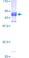 PDEF / SPDEF Protein - 12.5% SDS-PAGE of human SPDEF stained with Coomassie Blue