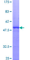 PDGF-AA Protein - 12.5% SDS-PAGE of human PDGFA stained with Coomassie Blue