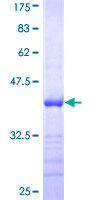 PDGF-AA Protein - 12.5% SDS-PAGE Stained with Coomassie Blue.