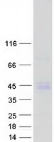 PDGF-AA Protein - Purified recombinant protein PDGFA was analyzed by SDS-PAGE gel and Coomassie Blue Staining