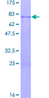 PDGF-CC Protein - 12.5% SDS-PAGE of human PDGFC stained with Coomassie Blue