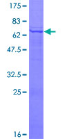 PDGF-D Protein - 12.5% SDS-PAGE of human PDGFD stained with Coomassie Blue