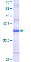 PDGF-D Protein - 12.5% SDS-PAGE Stained with Coomassie Blue.