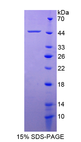 PDGF-D Protein - Recombinant  Platelet Derived Growth Factor D By SDS-PAGE
