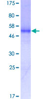 PDGFRA / PDGFR Alpha Protein - 12.5% SDS-PAGE of human PDGFRA stained with Coomassie Blue