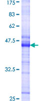 PDGFRA / PDGFR Alpha Protein - 12.5% SDS-PAGE Stained with Coomassie Blue.
