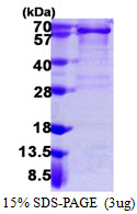 PDGFRA / PDGFR Alpha Protein