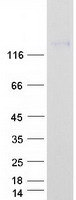 PDGFRA / PDGFR Alpha Protein - Purified recombinant protein PDGFRA was analyzed by SDS-PAGE gel and Coomassie Blue Staining