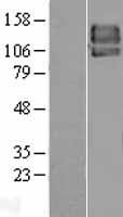 PDGFRB / PDGFR Beta Protein - Western validation with an anti-DDK antibody * L: Control HEK293 lysate R: Over-expression lysate