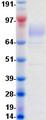 PDGFRB / PDGFR Beta Protein