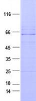 PDGFRB / PDGFR Beta Protein