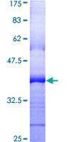 PDGFRB / PDGFR Beta Protein - 12.5% SDS-PAGE Stained with Coomassie Blue.