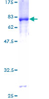 PDHA1 / PDH E1 Alpha Protein - 12.5% SDS-PAGE of human PDHA1 stained with Coomassie Blue
