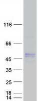 PDHA1 / PDH E1 Alpha Protein - Purified recombinant protein PDHA1 was analyzed by SDS-PAGE gel and Coomassie Blue Staining