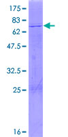 PDHA2 / PDH E1 Beta Protein - 12.5% SDS-PAGE of human PDHA2 stained with Coomassie Blue