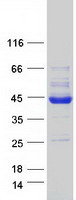 PDHA2 / PDH E1 Beta Protein - Purified recombinant protein PDHA2 was analyzed by SDS-PAGE gel and Coomassie Blue Staining
