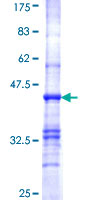 PDHB Protein - 12.5% SDS-PAGE Stained with Coomassie Blue.