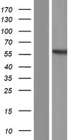 PDHX / Protein X / ProX Protein - Western validation with an anti-DDK antibody * L: Control HEK293 lysate R: Over-expression lysate