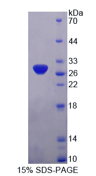 PDHX / Protein X / ProX Protein - Recombinant  Pyruvate Dehydrogenase Complex Component X By SDS-PAGE