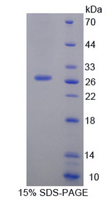 PDIA2 Protein - Recombinant  Protein Disulfide Isomerase A2 By SDS-PAGE